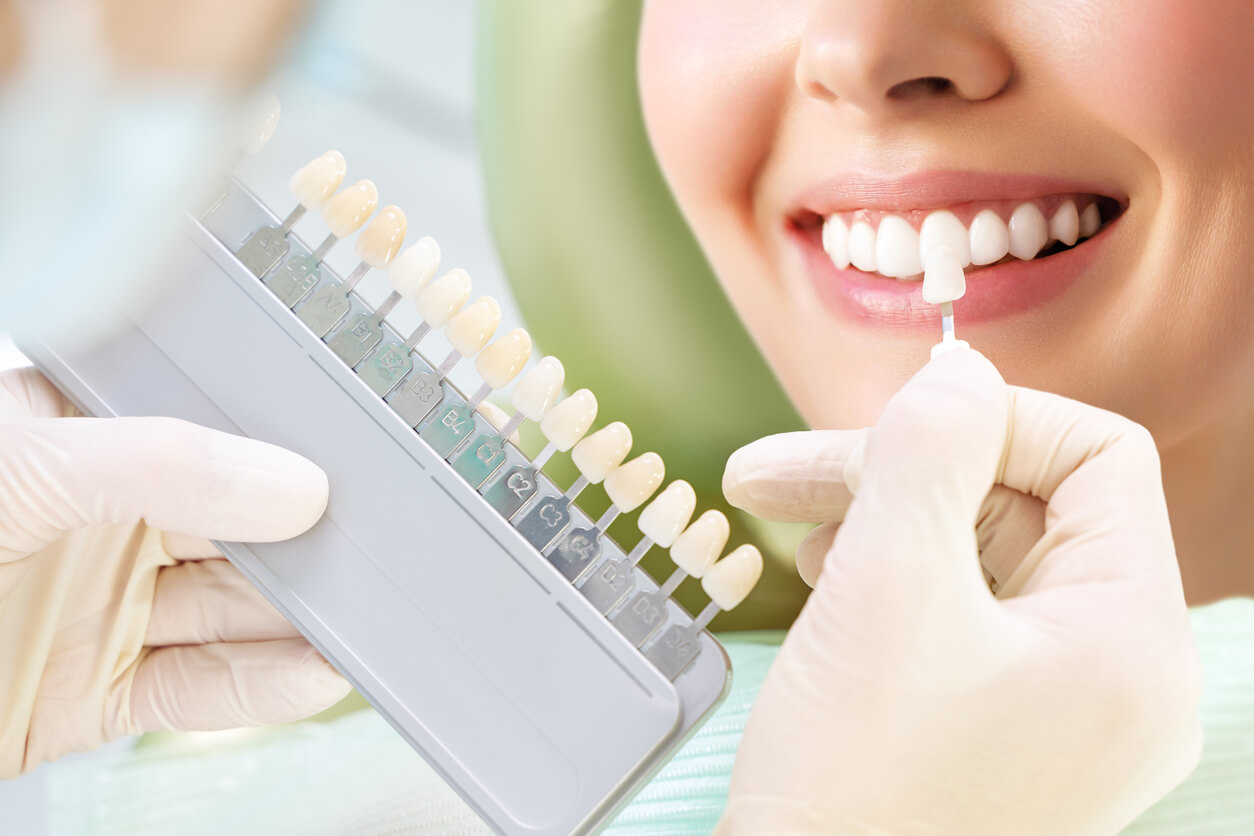 Cosmetological teeth whitening in a dental clinic