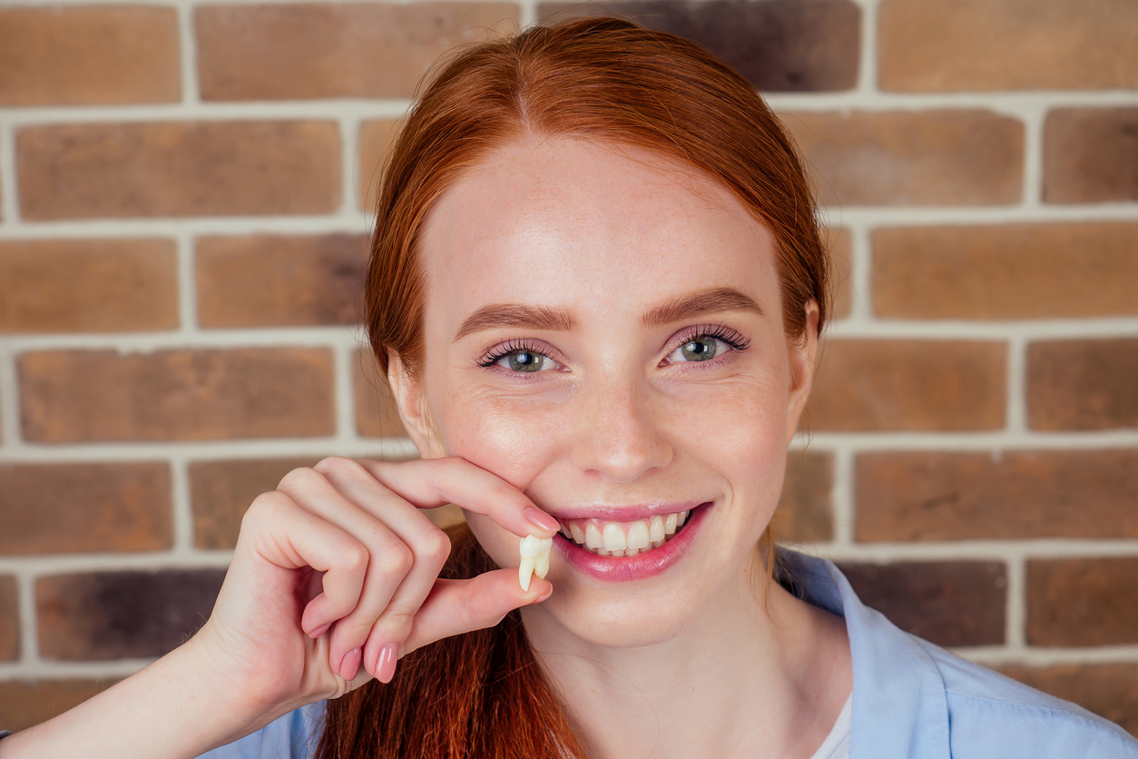 redhaired ginger female with snow-white smile holding white wisdom tooth after surgery removal of a tooth Wisdom Teeth Extraction