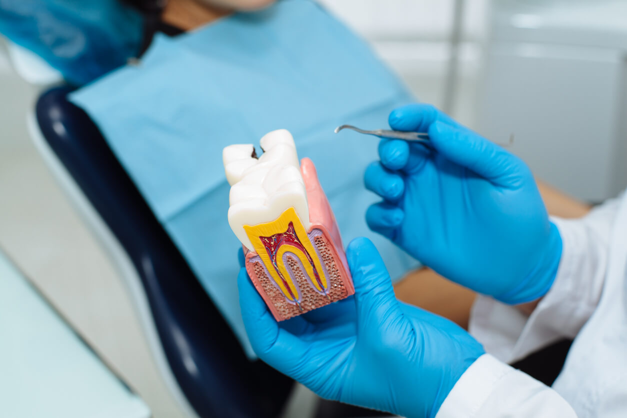 Tooth Enamel